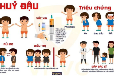 BÀI TUYÊN TRUYỀN PHÒNG CHỐNG THỦY ĐẬU